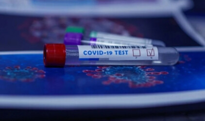 В Оренбурге предложили ежедневно тестировать на COVID-19 строителей областной детской больницы